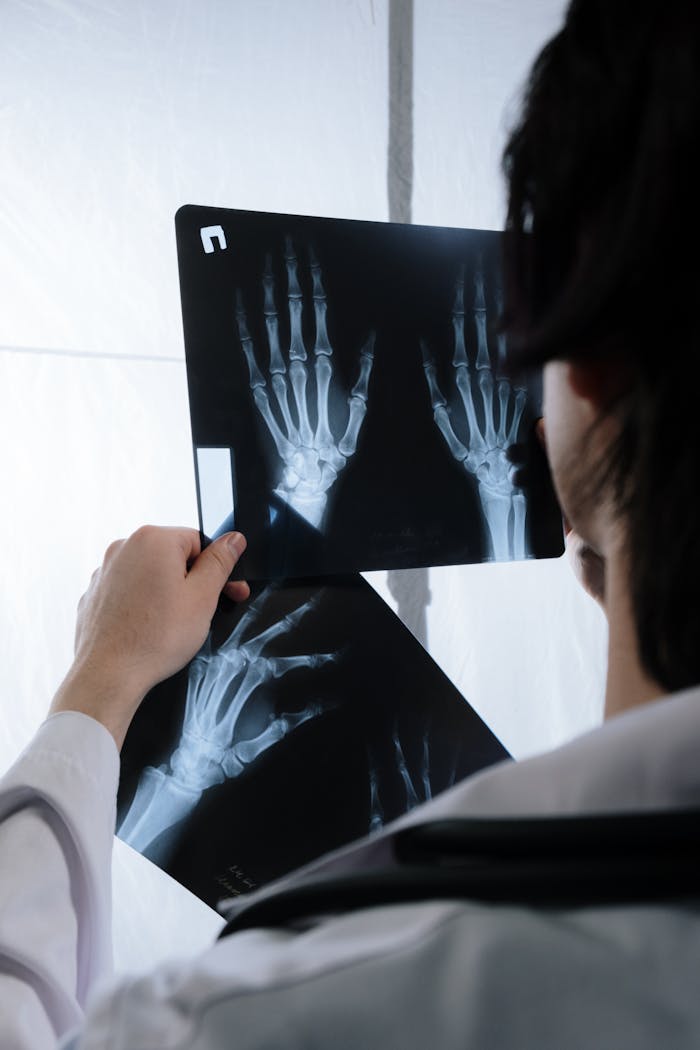 Broken Bone Compensation Claim in the UK